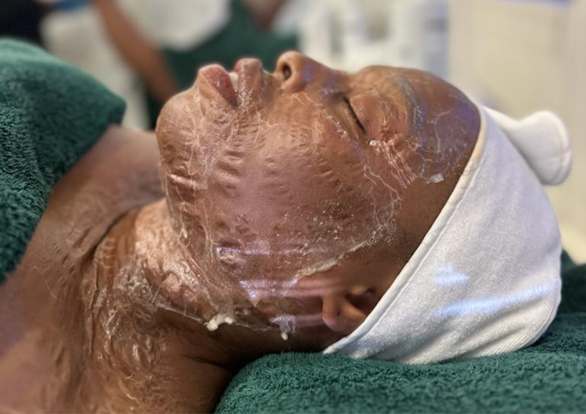 Facial Treatments Facial Treatments